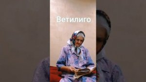Отвечаю На Вопросы об Витилиго. Что Нужно Употреблять, а Что Исключить. Рецепты Настоев и Мази