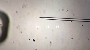 Часть 2/1: забор яйцеклеток, пункция, мы в клинике.