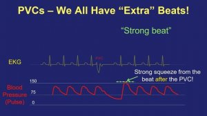 PVCs: Symptoms and Treatment - in Plain English!