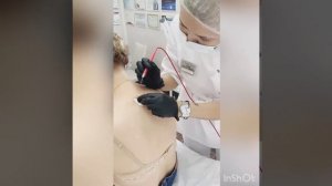 Радиоволновое удаление новообразований