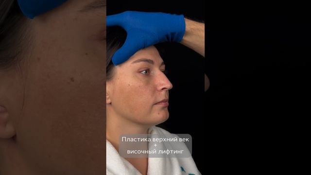 За одну операцию изменилось многое!