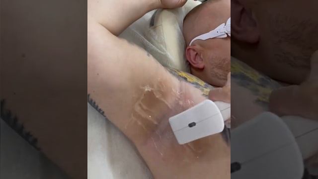 RazorLase️ diode laser hair machine диодный лазер для удаления волос