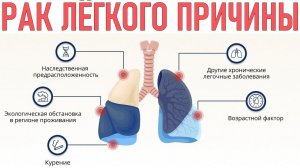 LR : Рак 4 степени.Шанс на жизнь.Отзыв и методика восстановления от врача-онколога
