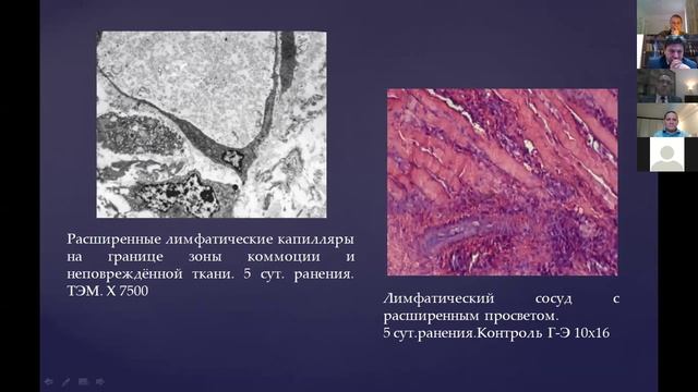 Джумабаев. Региональная лимфатическая терапия в хирургии быстрой реабилитации огнестрельных ранений