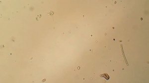 Амеба и инфузория на 4:35 сокращается вакуоль.