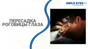 Пересадка роговицы глаза  (сквозная кератопластика) от чего зависит успех операции?