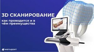 Самая точная диагностика в стоматологии - 3D сканирование зубов в "Мега-Дент"