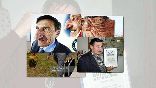 Человек с самым длинным носом в мире попал в Книгу рекордов Гиннесса