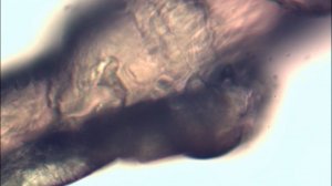 Живой паразит Демодекс под микроскопом, Human Demodex Follicles Mites