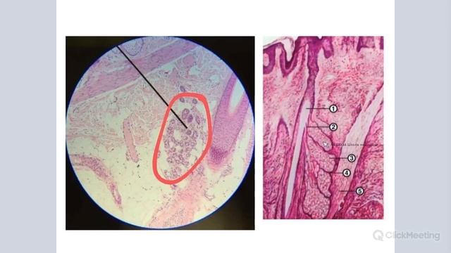 КОЖА С ВОЛОСОМ | Разбор гистологического препарата смотреть онлайн
