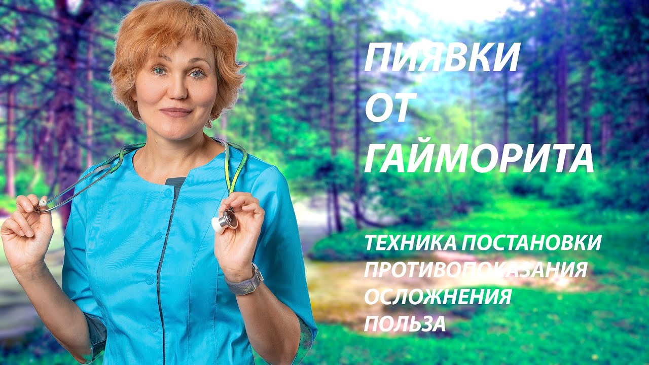 Пиявки от гайморита.mp4 смотреть онлайн