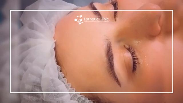 Термолифтинг Reaction смотреть онлайн