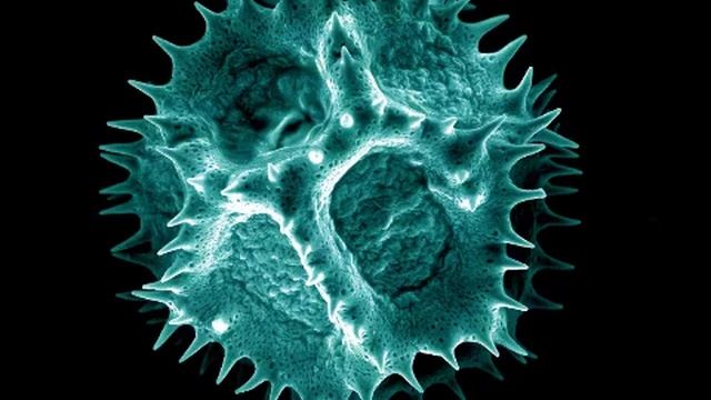 Z-Strain - Microscopic смотреть онлайн