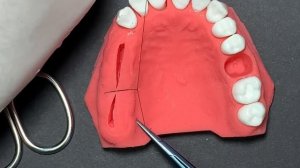 Все виды швов 5. Шов Ламбера