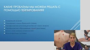 ✅ ТЕЙПИРОВАНИЕ ВО ВРЕМЯ БЕРЕМЕННОСТИ | Наталья Суворова | Учебный центр BBALANCE