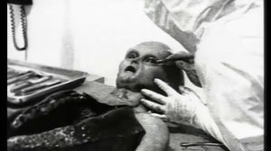 Alien Autopsy