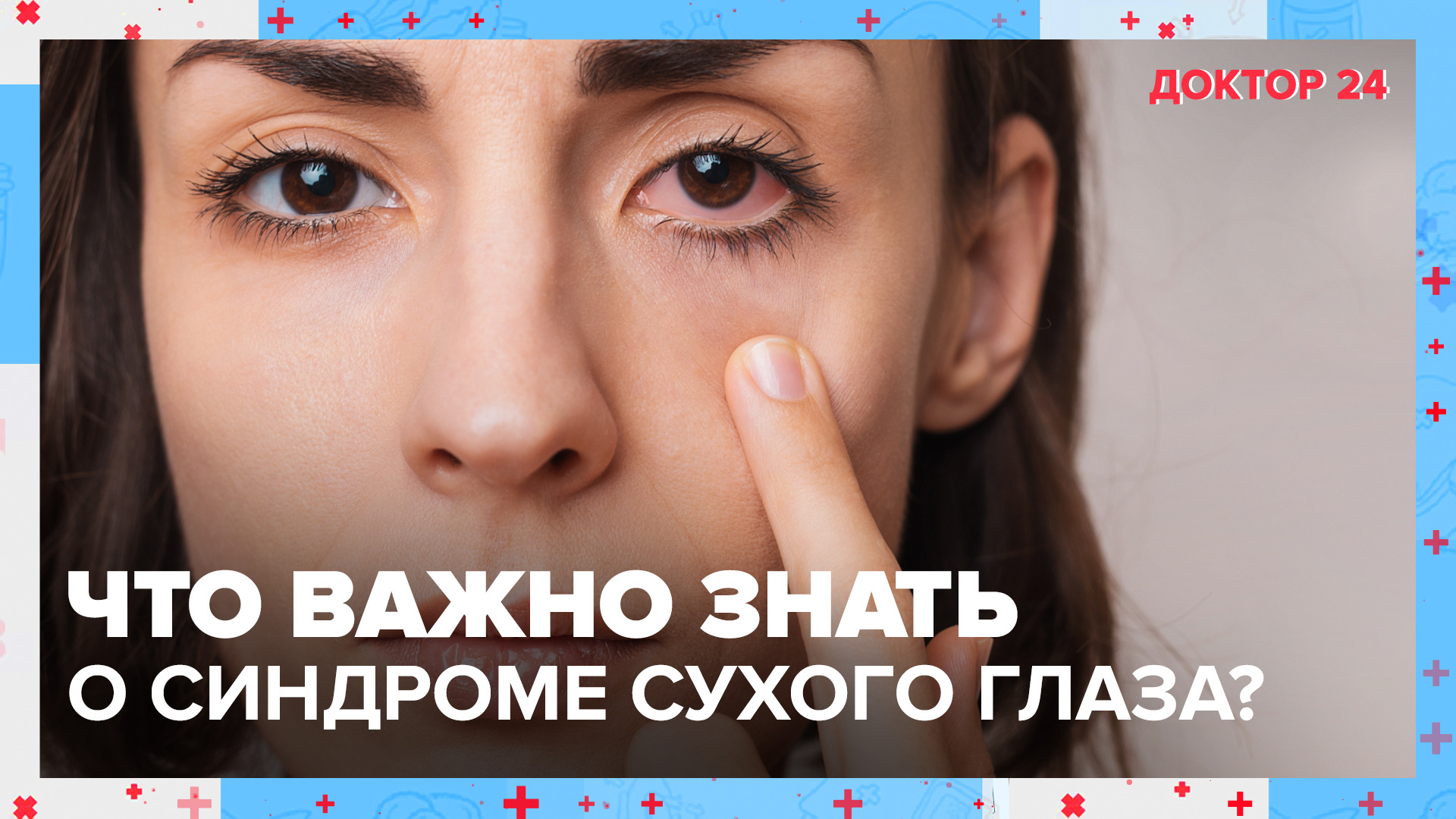 Что важно знать о СИНДРОМЕ СУХОГО ГЛАЗА? | Доктор 24