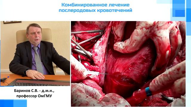 Комбинированное лечение послеродовых кровотечений Баринов СВ смотреть онлайн