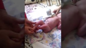 Плоско-вальгусная деформация стопы массаж