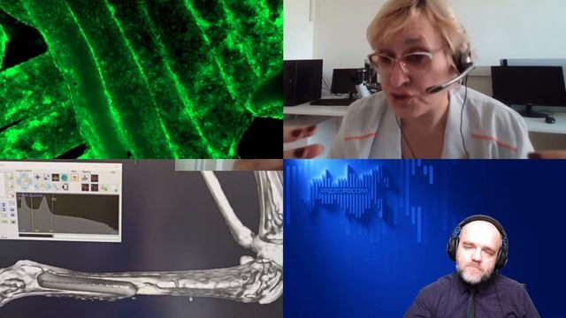 1120. Н. Ю. Анисимова: Искусственные кости. Управление ростом клеток на поверхности композитов смотреть онлайн