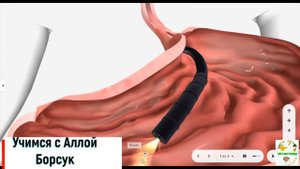 Эндоскопия,биопсия желудка в 3 Д атласе.