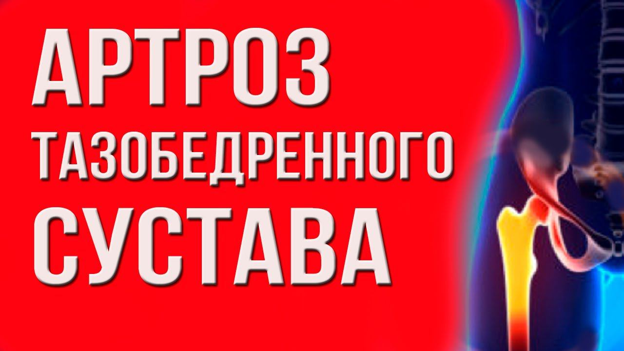 Деформирующий артроз тазобедренного сустава. Как сохранить здоровье суставов?