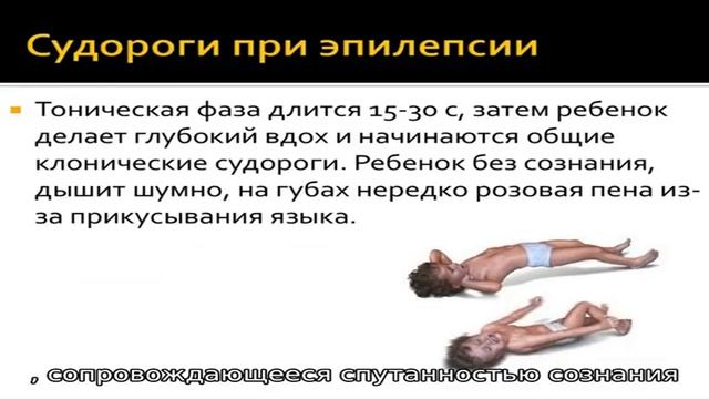 Судороги при гипертермии смотреть онлайн