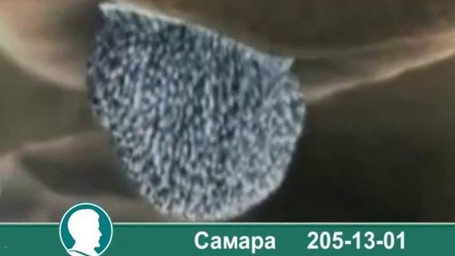 Липосакция аппаратная в клинике Самары смотреть онлайн