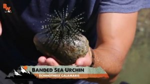 Ужалил ядовитый морской еж!!!!