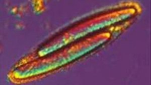 Можно ли увидеть бактерии невооружённым глазом?