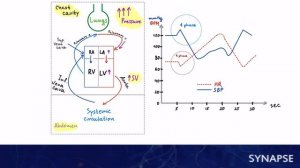 USMLE Step 1 - Манёвр Вальсальвы