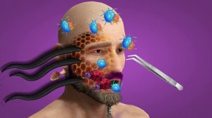 ASMR Remove Maggots & Dog Ticks Infected Face | Severely Injured Animation