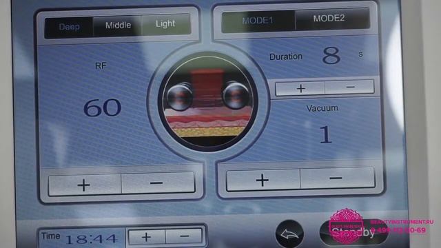 Обзор аппарата AnchorFree V8C2