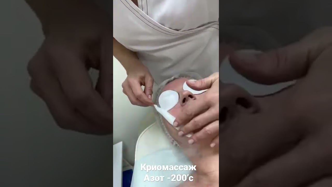Криомассаж / жидкий азот /удаление папиллом и бородавок