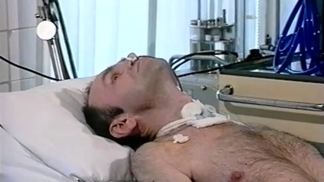 Нетравматический апаллический синдром