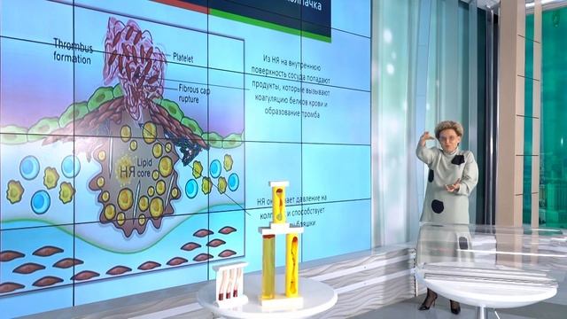 Патофизиология атеросклероза (лектор Е.В.Малышева)