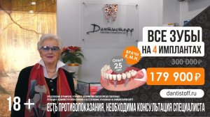 Какие протезы зубов лучше?⭐️ +7 (495) 255-59-37⭐️ Анна Шатилова выбирает клинику Дантистофф!