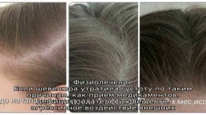 Как вернуть густоту волосам после выпадения