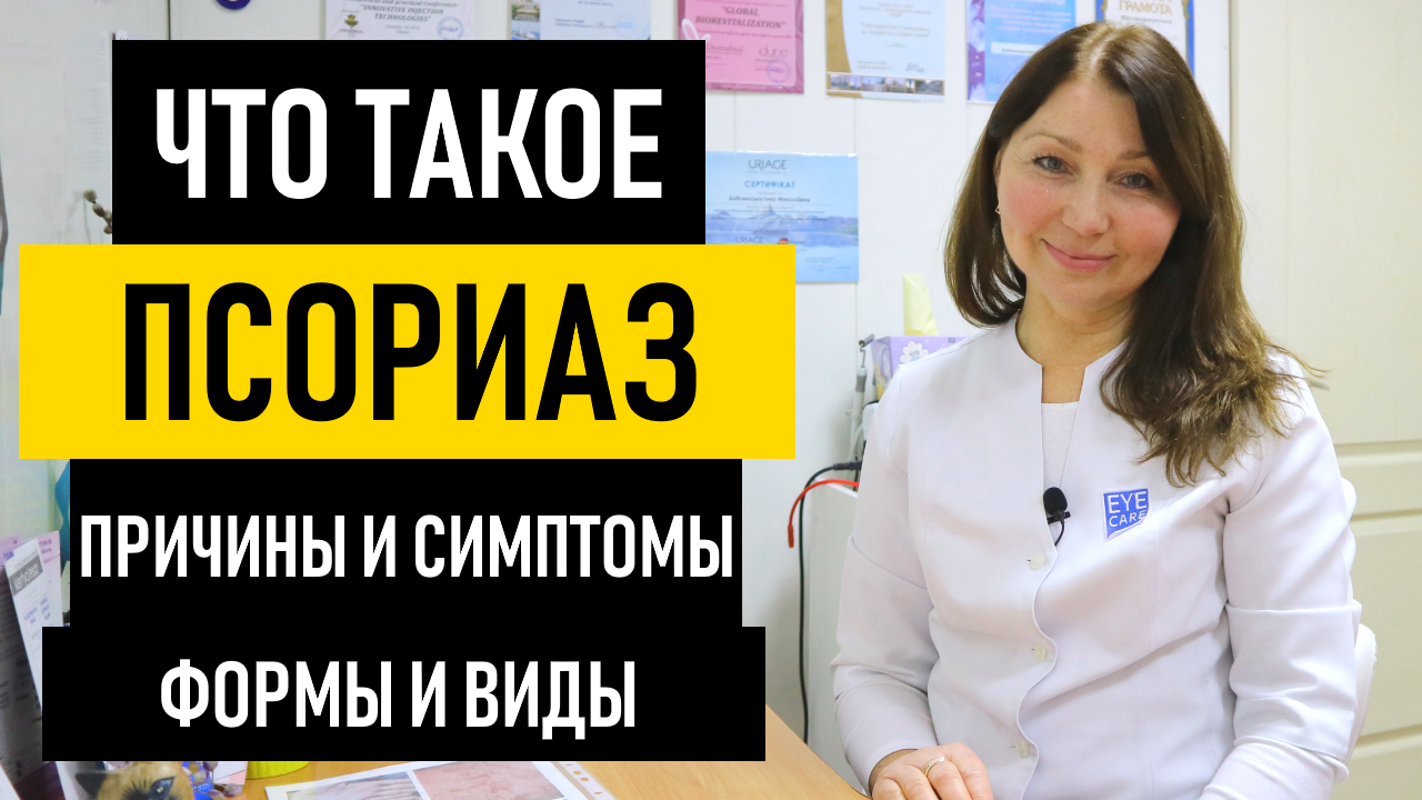 Что такое псориаз. Причины и симптомы псориаза. Виды и диагностика чешуйчатого лишая смотреть онлайн