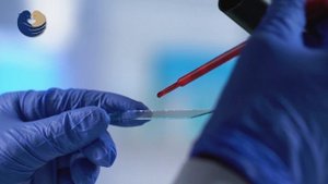 Рак ротоглотки: симптомы, диагностика, лечение.