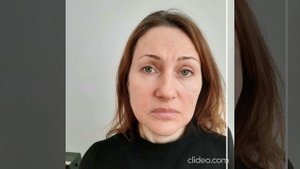 Омоложение Результат.mp4