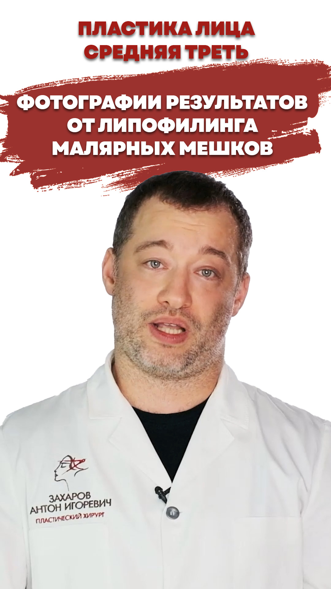 Фотографии результатов от липофилинга малярных мешков