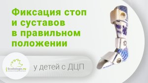 Тутор  - аппарат для коррекции деформации. Фиксирует стопу и суставы в правильном положении.