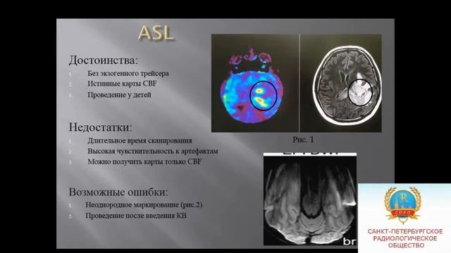 Гоголева С.С. «Методика МР-перфузии. Роль рентгенолаборанта» смотреть онлайн