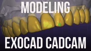 Live Exocad training Desing. Live WaxUp. Modeling. Моделирование Виниры