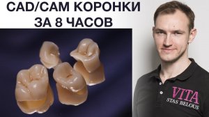 Коронки за 8 часов CEREC Vita #SUPRINITY #vitazahnfabrik Stas Belous Стас Белоус