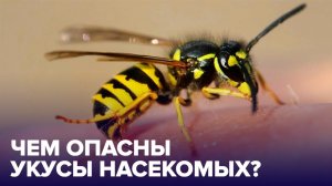 Первая помощь при УКУСАХ НАСЕКОМЫХ – как правильно ее оказывать?