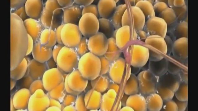 Лазерная липосакция на аппарате Smartlipo