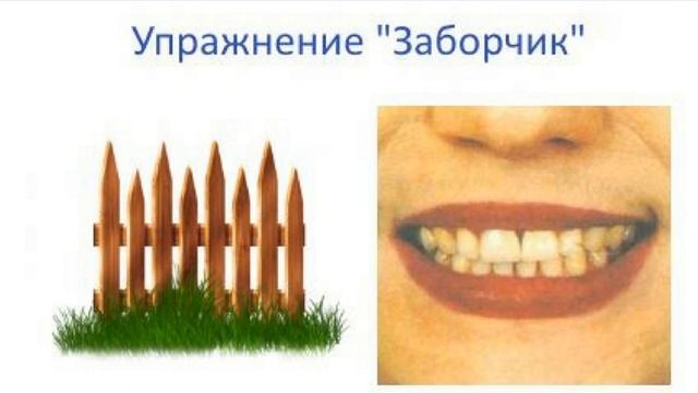 Артикуляционная гимнастика для детей. Артикуляционное упражнение заборчик. Детский логопед. смотреть онлайн