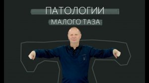 Патологии малого таза.Доктор Кириллов.